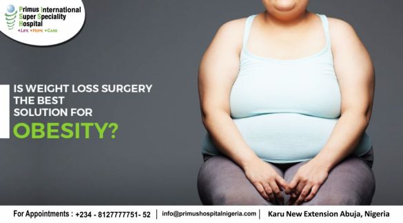 Weight Loss Surgery-Primus hospital